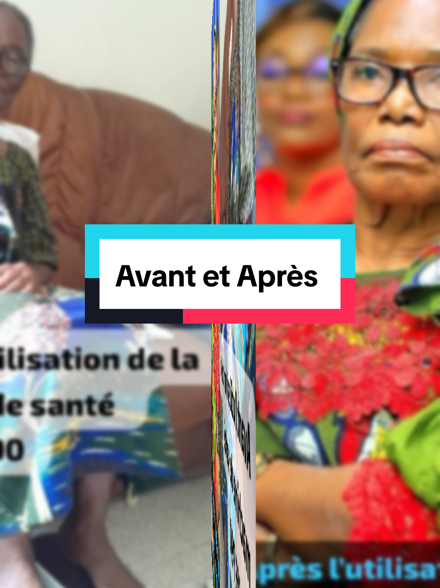 Avant et après l'utilisation de la machine Tera-p90  #visibilité #fyp #vues #viralvideos @