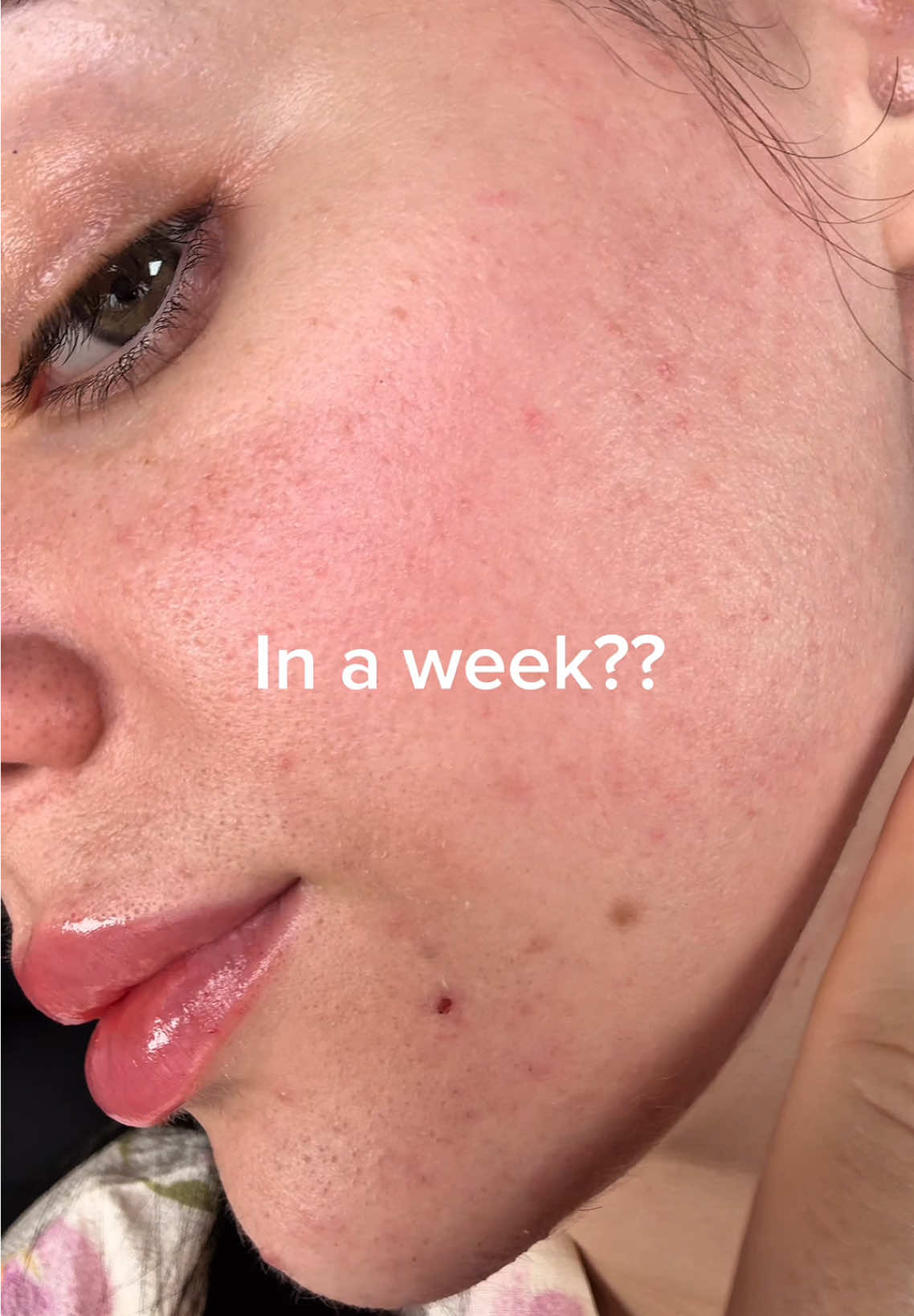 just like that skin turned into glass @SKIN1004 US brightening ampoule 🤍✨ #skincare #skintok #kbeauty #koreanskincare #oliveyoung #serum #pores #acne #fyp 