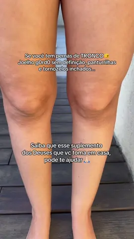 Amigas, comenta aqui quem tem a perna de tronco assim como eu 👇🏻👇🏻 #lipedema #pernas