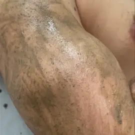 Peeling des bras pour traiter les taches d’acné. Rien ne résiste aux algues 😅😅😅 #peeling #soin #soinsnaturels #soincorps #soinduvisage #peelingauxalgues