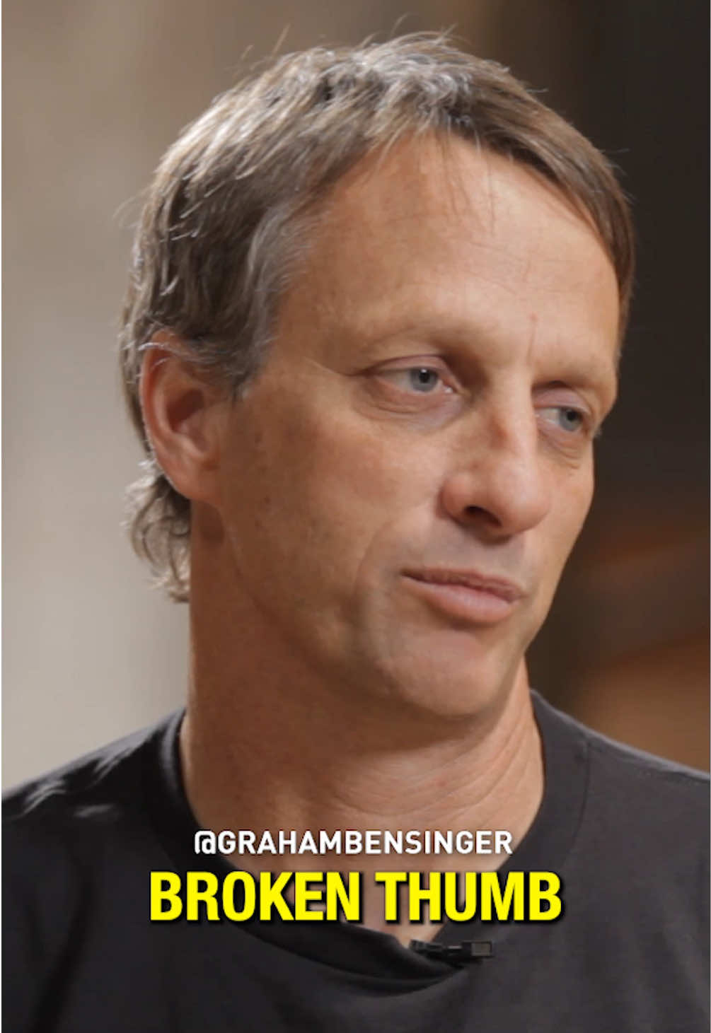 Tony Hawk says his worst injury didn’t happen during competition—it happened while filming a wild stunt with Steve-O and Chris Pontius. #tonyhawk #steveo #Skateboarding 