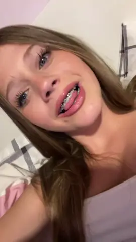 i know i’m ur fav #fyp #viral #blowthisupforme #braces #teen 