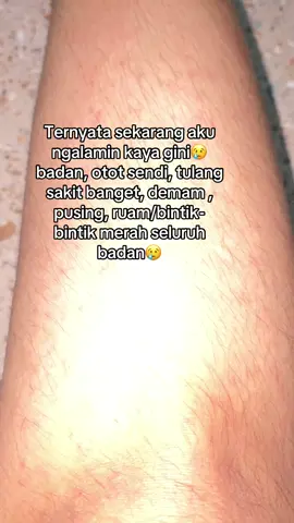 Gejalanya sama percis sama virus Chikungunya tapi kata dokter ini Campak 😢 cape banget otot sendi sama tulang sakit bangett😭😭 #penyakit_Campak #chikungunya🦟 #virus_chingunhunya #campak #bintikbintikmerah #fypdong 