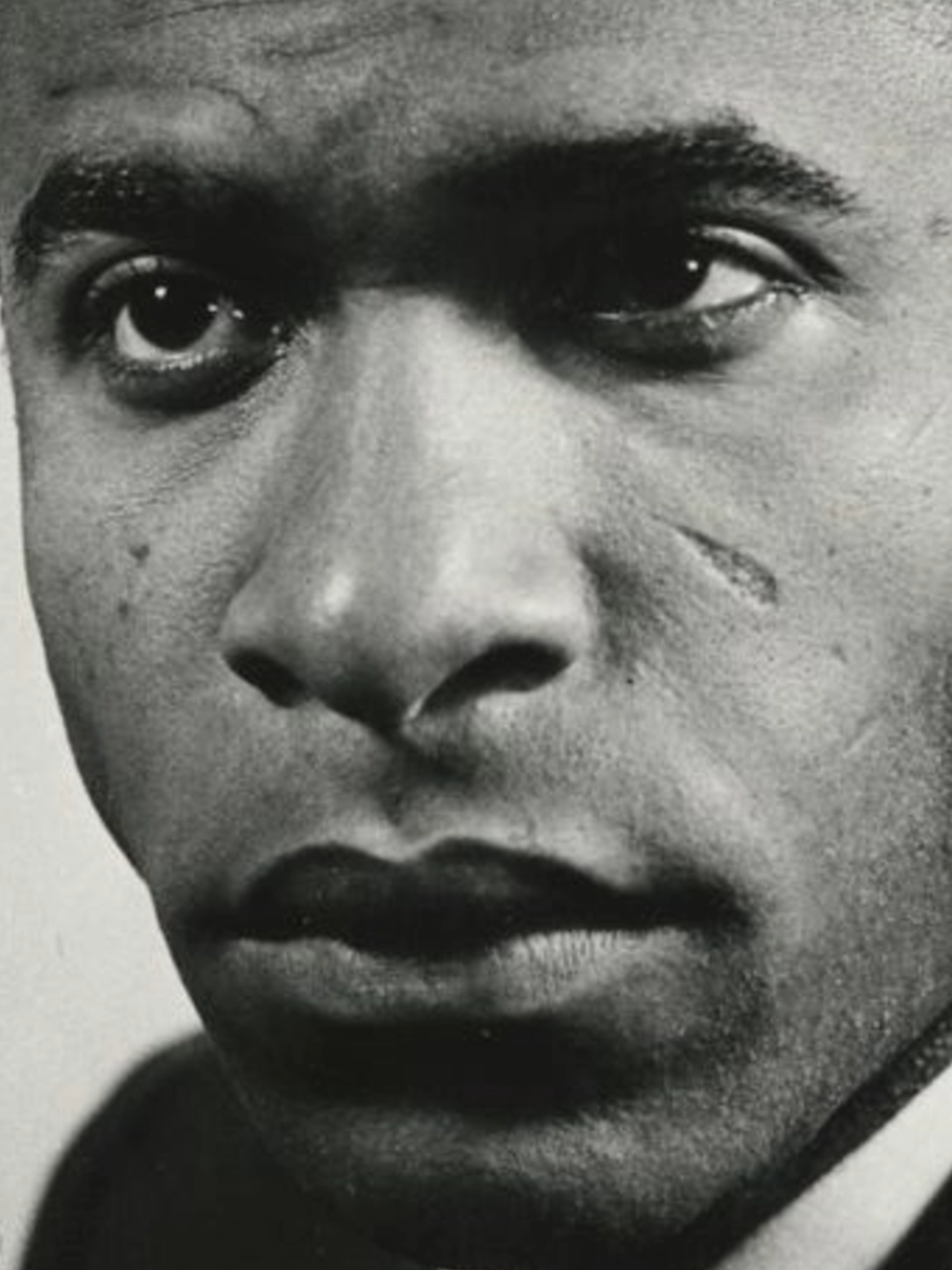 La blouse blanche, nouvelle arme du colonialisme ? Frantz Fanon découvre l’envers de la psychiatrie coloniale à Blida : traitements violents, discours racistes, médecine utilisée pour dominer. Face à l’école d’Antoine Porot, il résiste, dénonce… et rejoint la révolution. Quand la science devient pouvoir, est-elle encore neutre ? #FrantzFanon #AntoinePorot #PsychiatrieColoniale #Colonialisme #Algérie #Histoire #Décolonisation #Mémoire #FLN #ScienceEtPouvoir #TikTokHistoire