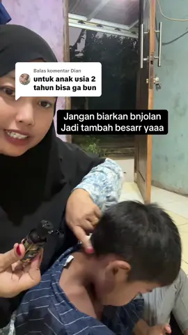 Membalas @Dian minyak memang untuk bnjolan atau Uci uci#minyak#herbal 