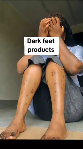 Dark feet products  #darkfeet #trendingvideos #luxurylifestyle #skinwi #cruise #nigeriantiktok🇳🇬 