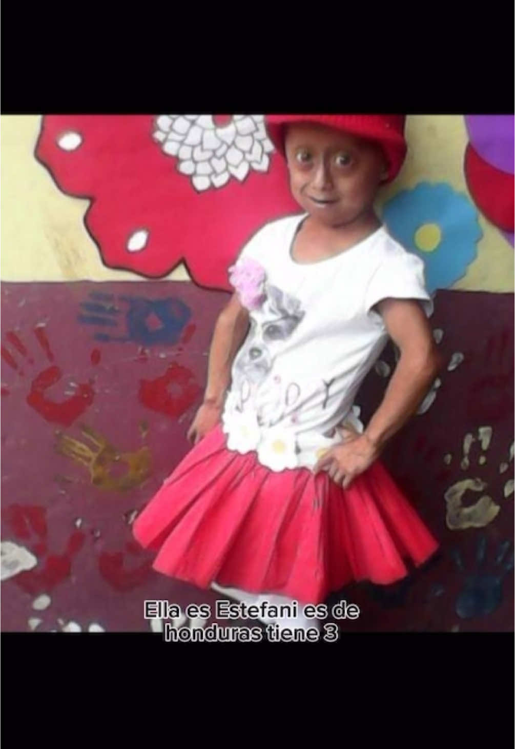Un poquito sobre mi💕 #unpoquitosobremi #foryoupageofficiall #foryoupage #viraltiktok #paratiiiiiiiiiiiiiiiiiiiiiiiiiiiiiii #grwmestefani #paratiiiiiiiiiiiiiiiiiiiiiiiiiiiiiii #progeria #mivida #conocemassobremi 