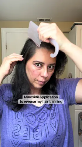 Did you know there are 3 FDA approved applications for hair thinning. LLLT, minoxidil, & finasteride.  That simply means research and studies have proven that these systems work.  I’m using both LLLT with my Hairmax laser comb and minoxidil 3x week.  Results take time but I’m already seeing promise.  Do you use any of these for your hair? . . #hairtok #minoxidil #thinhair #finehair #LLLT #hairregrowth #hairgrowthjourney 
