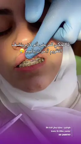 تنظيف التقويم 3 مرات يوميًا = ابتسامة صحية وأجمل! 🦷✨ إذا كنتِ مركبة تقويم، تنظيف الأسنان بعد كل وجبة أمر ضروري جدًا! 🍽️➡️🪥 بقايا الأكل تعلق بسهولة بين الأسلاك والحاصرات، ومع الوقت ممكن تسبب: ❌ تسوس ❌ رائحة فم كريهة ❌ التهابات في اللثة الحل؟ ✅ فرشاة أسنان مناسبة ✅ خيط تقويم ✅ غسول فم = طقم العناية المثالي! خلي ابتسامتك الحلوة تكون صحية كمان 😉 ‏‎📍عنوانا : طولكرم - شارع نابلس /مجمع الدنا التجاري ‏‎‏‎‏‎لإستفساراتكم  يرجى التواصل على 📍الأرقام التالية :   📱0599335698 📱0525872992  ☎️2689797    #تجميل #ليزر #ازالة_شعر #فيلر #بوتكس  #اكسبلور #أسنان #تبييض 