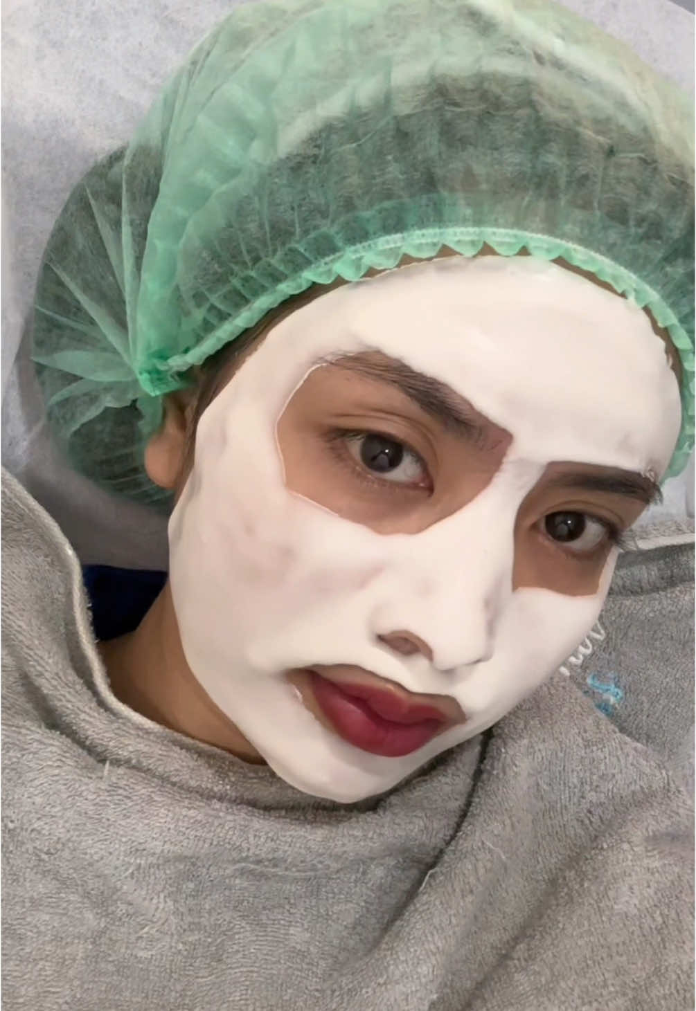 Beauty is pain 😮‍💨 @DermaExpress Bali  #treatment #treatmentwajah #dnasalmon #dermaexpress 