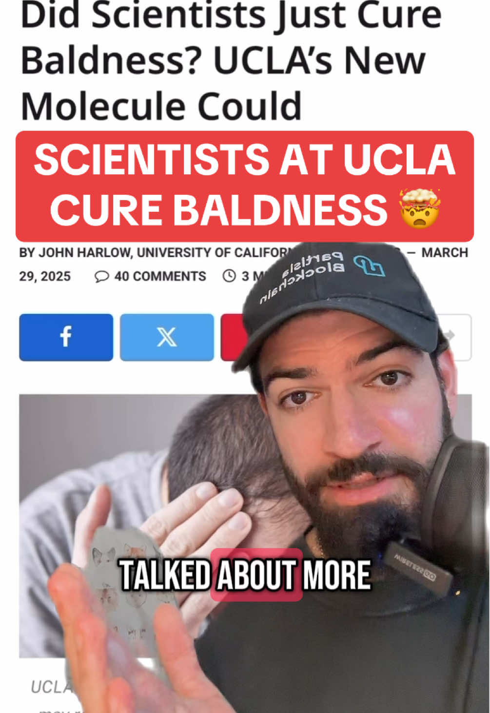 Scientists At UCLA claim to have cured BALDNESS! 🤯 