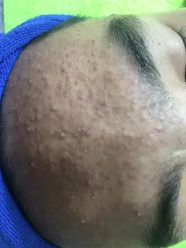 Hành trình gần 2tháng của bạn ý