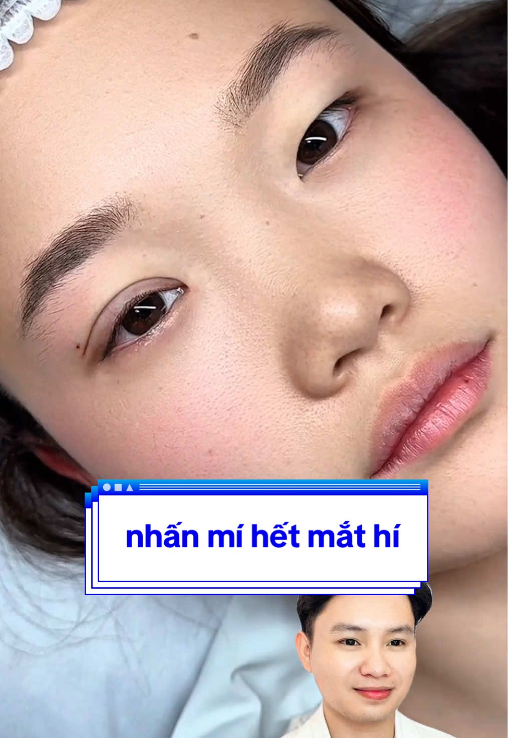 Nhấn mí hết mắt hí , làm có tí đã đẹp rồi ?? #catmi #thammyantoan #fyp #miđep 