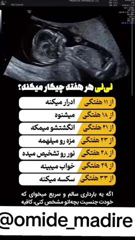 اولین بار کی باهاش حرف زدی؟👶🏻🤰🏻 جنین از هفته ۱۸قدرت شنوایی داره 😍و تو باید حتما هر روز کلی وقت بذاری براش🥹👧🏻حالا بگو ببینم از قبل بارداری باهاش حرف میزدی یا از هفته ۱۸به بعد؟؟ 🔗 @omide_madari  📲 @instatoolboxbot