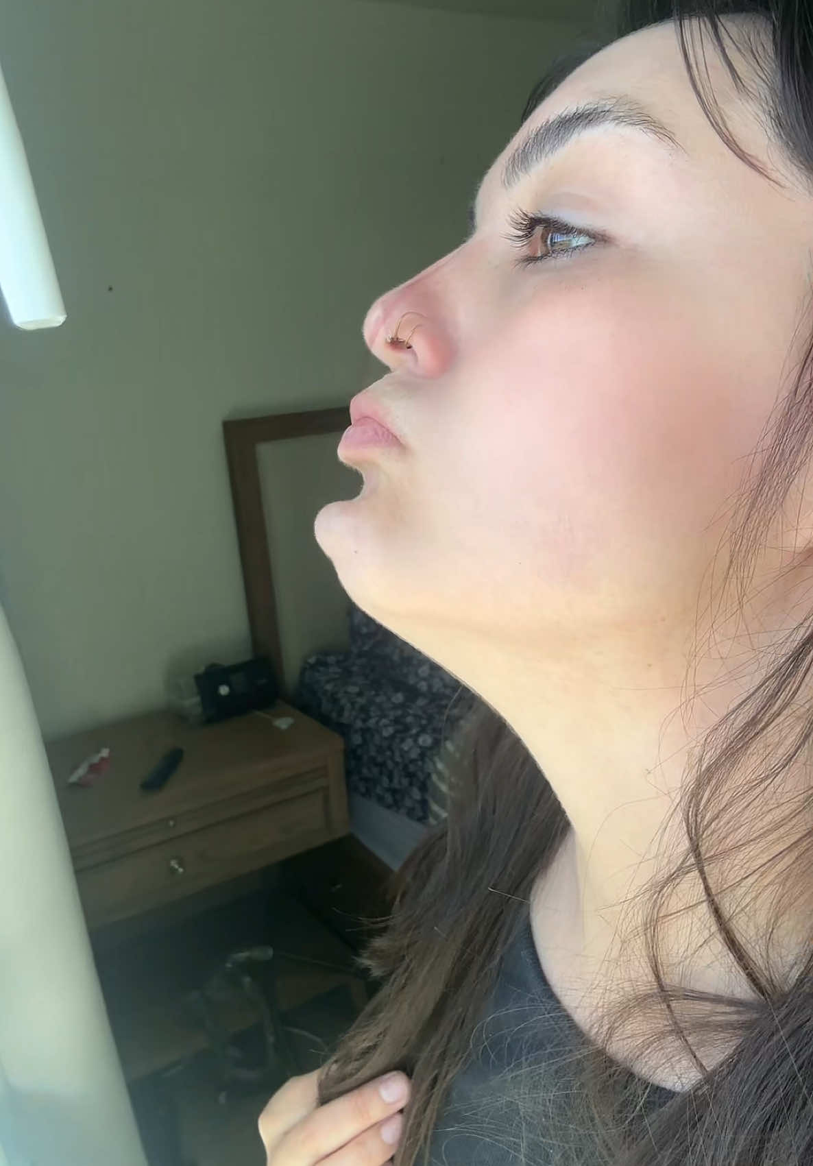 Botox chin b0ner. As an injector for almost the last 10 years, nothing could have prepared me for this 🤣. Where are my other choners at? #botox #chinbotox #mentalis #rninjector #nurseinjector