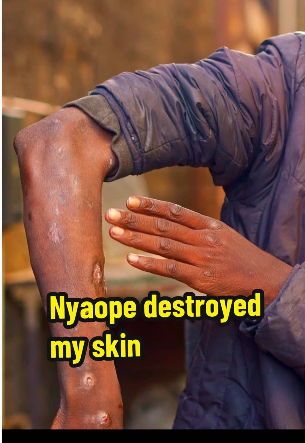 The effects of Nyaope Full episode on YouTube #streetinterview #mzansistories #homelesspeople #addiction #fyp #streetdocumentary #nyaope 