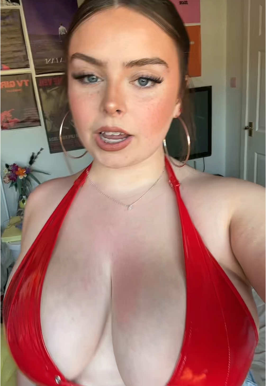 sunburnt 😞