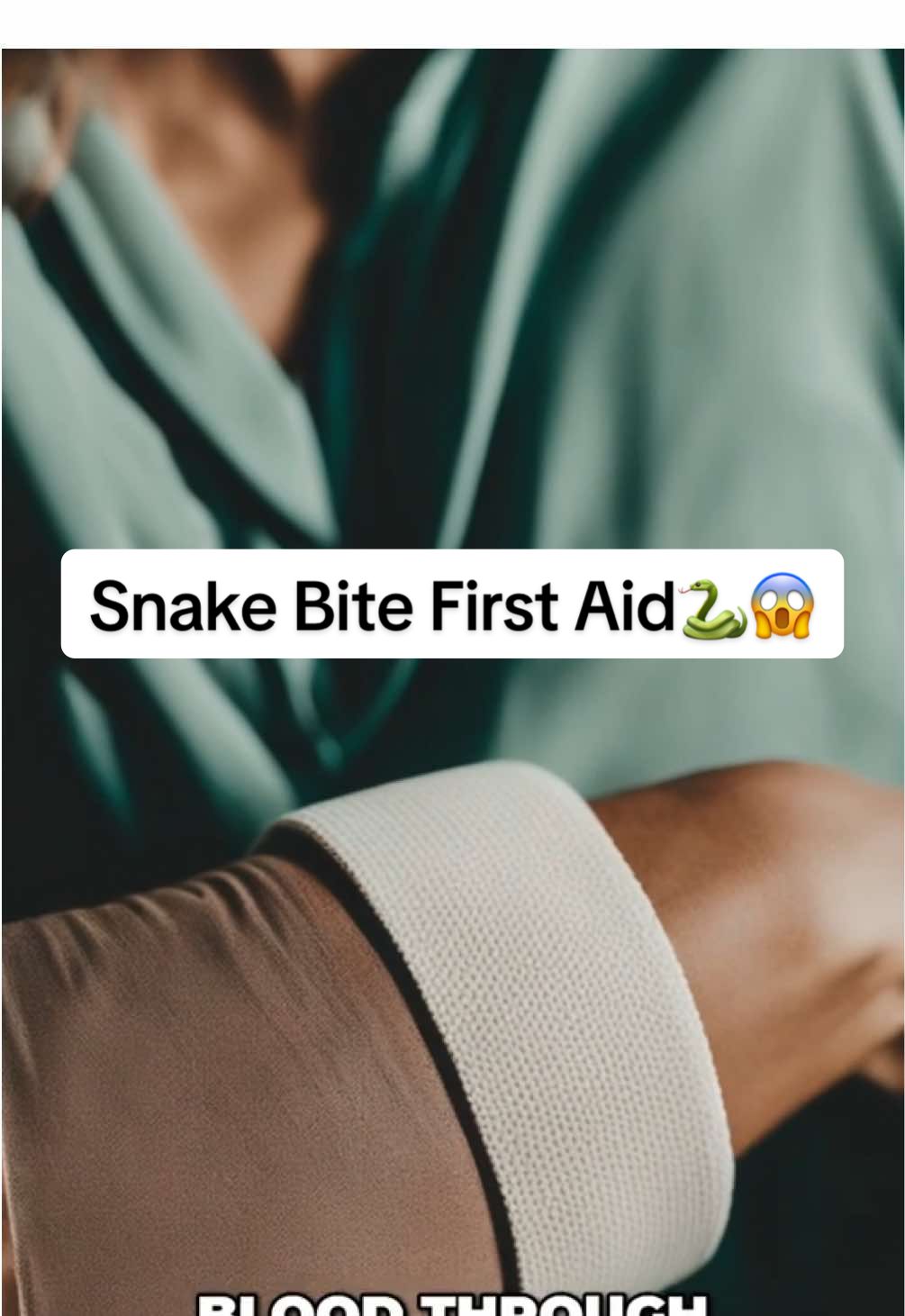 Snake Bite First Aid: What To Do Immediately! Snake bite? Our guide explains immediate first aid: slow heart rate, compress limb to slow venom spread. Stay calm; panic worsens the situation. Seek medical help quickly! #SnakeBite #FirstAid #VenomousSnake #SnakeAttack #SurvivalTips #EmergencyResponse #OutdoorSafety #WildlifeEncounter #SnakeSafety #MedicalEmergency