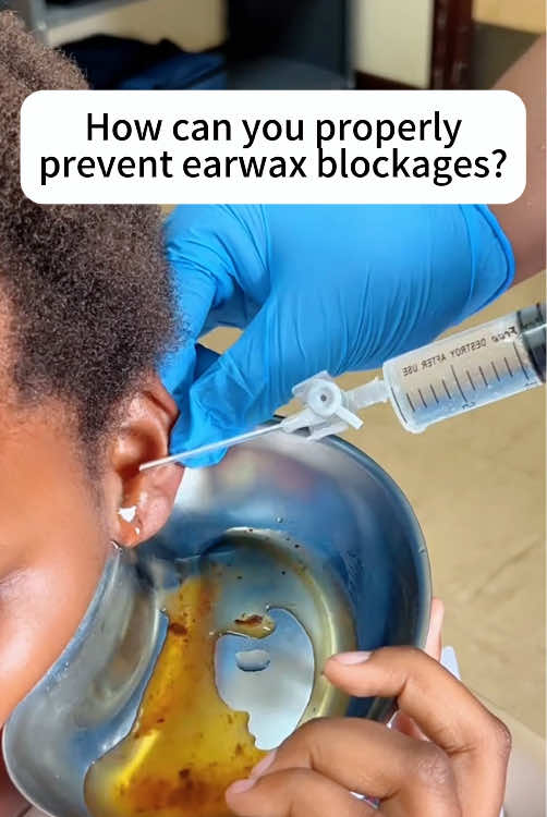 You haven't noticed how dirty your ears are, have you?#tiktokshop #earwaxremoval #earwax #gift #fypシ #2025 #chiristmas 