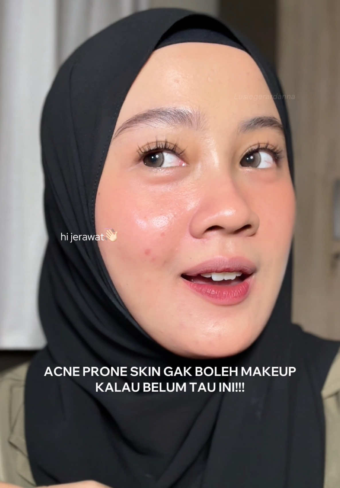 kamu acne prone skin tapi pingin makeup an? boleh kok. TAPI...... jangan lupa wajib bersihin makeup, bisa pake acne micellar water kayak giniii🫵🏻✨ #micellarwater #micellarwaterg2g #skincare #acneproneskin @glad2glow.indo 