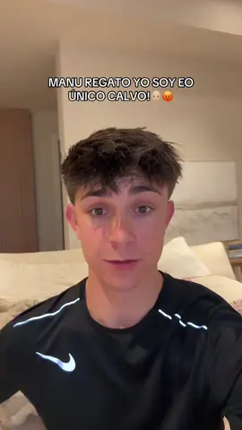 El rey de los calvos 🧑🏼‍🦲