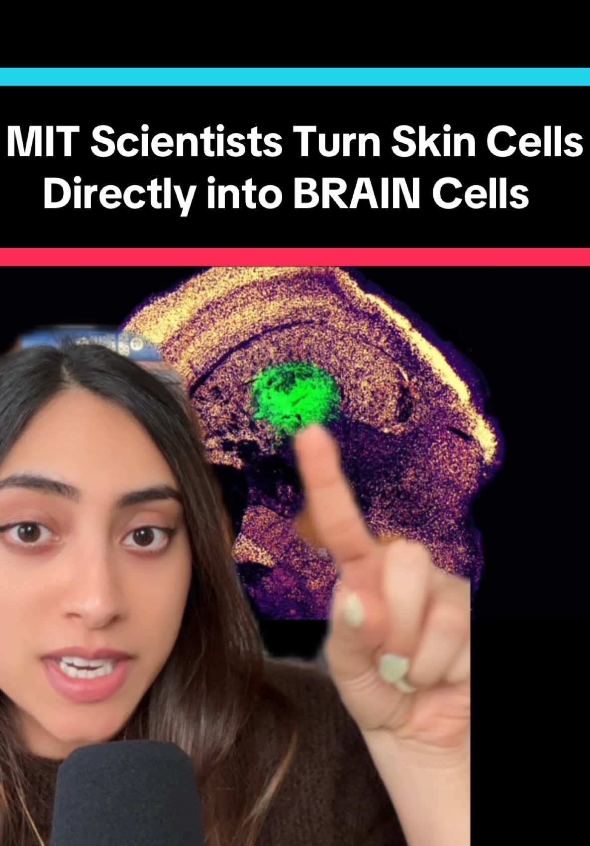 Science is so wild. MIT scientists figured out how to turn skin cells directly into BRAIN cells 🤯 Study: MIT engineers turn skin cells directly into neurons for cell therapy (MIT News) study linked in the article  #mindblown #science #EduTok #stemcells #medicine 