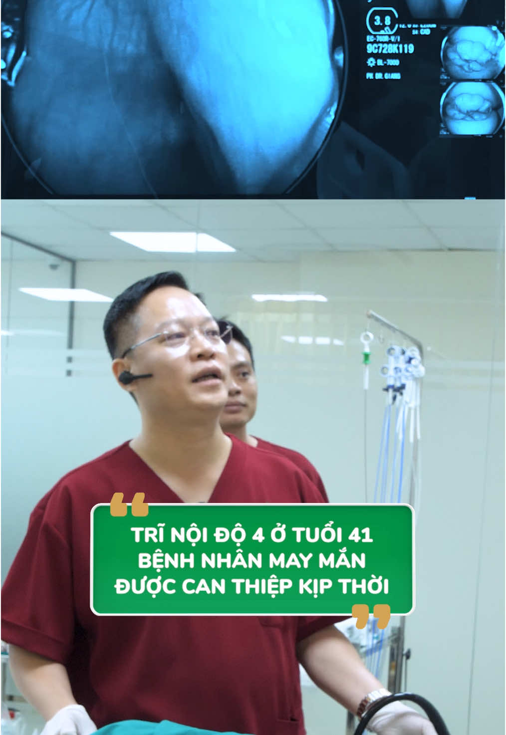 Bệnh nhân đến khám với tình trạng táo bón kéo dài, nội soi bất ngờ phát hiện trĩ nội độ 4 - mức độ nặng nhất! #trinoi #benhtri #noisoidaday #noisoidaitrang #noisoitieuhoa #bacsigiangnoisoi 