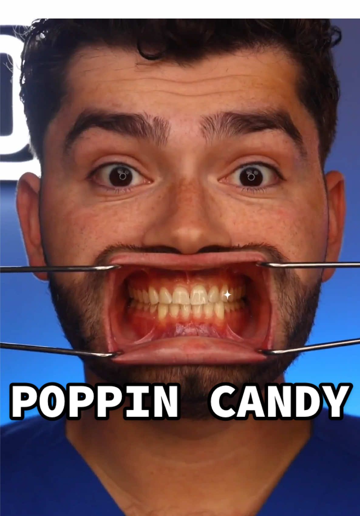 Dentist Approved Poppin Candy!? #dentist #satisfying #cleaning #breath 
