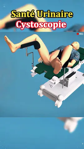 Peur de la cystoscopie ? Je t’explique tout en 60s ? #cystoscopie #santéurinaire #MedTikTok #conseilsanté #TuSaisPas?a #examenmédical #préventionsanté #tipsmédecins