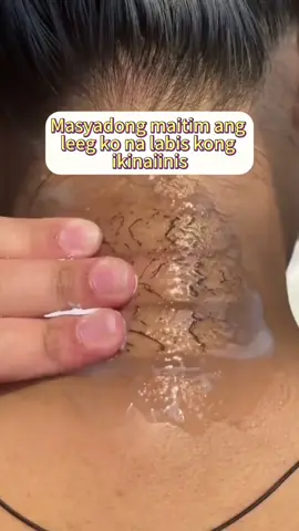 😭Dark skin? Here is what you need 👉SHE Eureka exfoliating gel! 👊Helps you whiten and brighten skin with a long-term use. Try is now, get yourself fair skin before someone else!✨🥳 #skincare  #exfoliation  #sheeureka  #fyp  PHRC2032