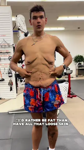 I would take more loose skin to be able to stay as happy as I am now. #fyp #weightloss #motivation #weightlosscheck #weightlosstransformation #overweight #weightlossprogress #weightlossjouney #foryou #GymTok #brodfit_21 