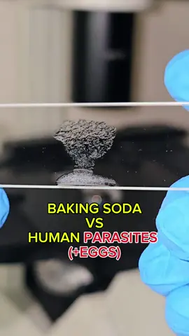 #bakingsoda #microscope #interesting #parasites 