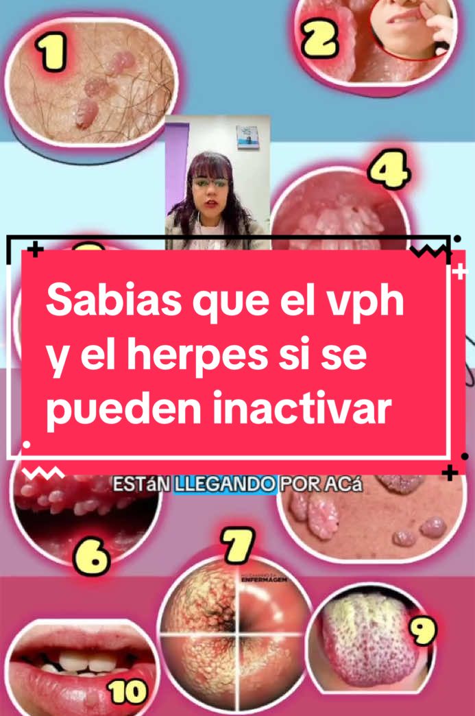 #tiktoklive #livehighlights #vph #virus #herpes #illinois #texa #miami #sanjose #sanantonio 