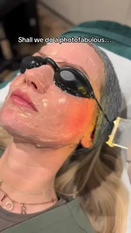 SAY LESS….!!! ⚡️✨  Photofabulous IYKYK The treatment packs a punch……but so do the results! 🤩 For more information ask below ⬇️  #skintok #fyp #skinconfidence #consistencyiskey #skinspecialist #skintreatments #skintherapist #photofabulous #pigmentationtreatment #glowingskin #antiagingtreatment #laserskinresurfacing #leeds #facialist 