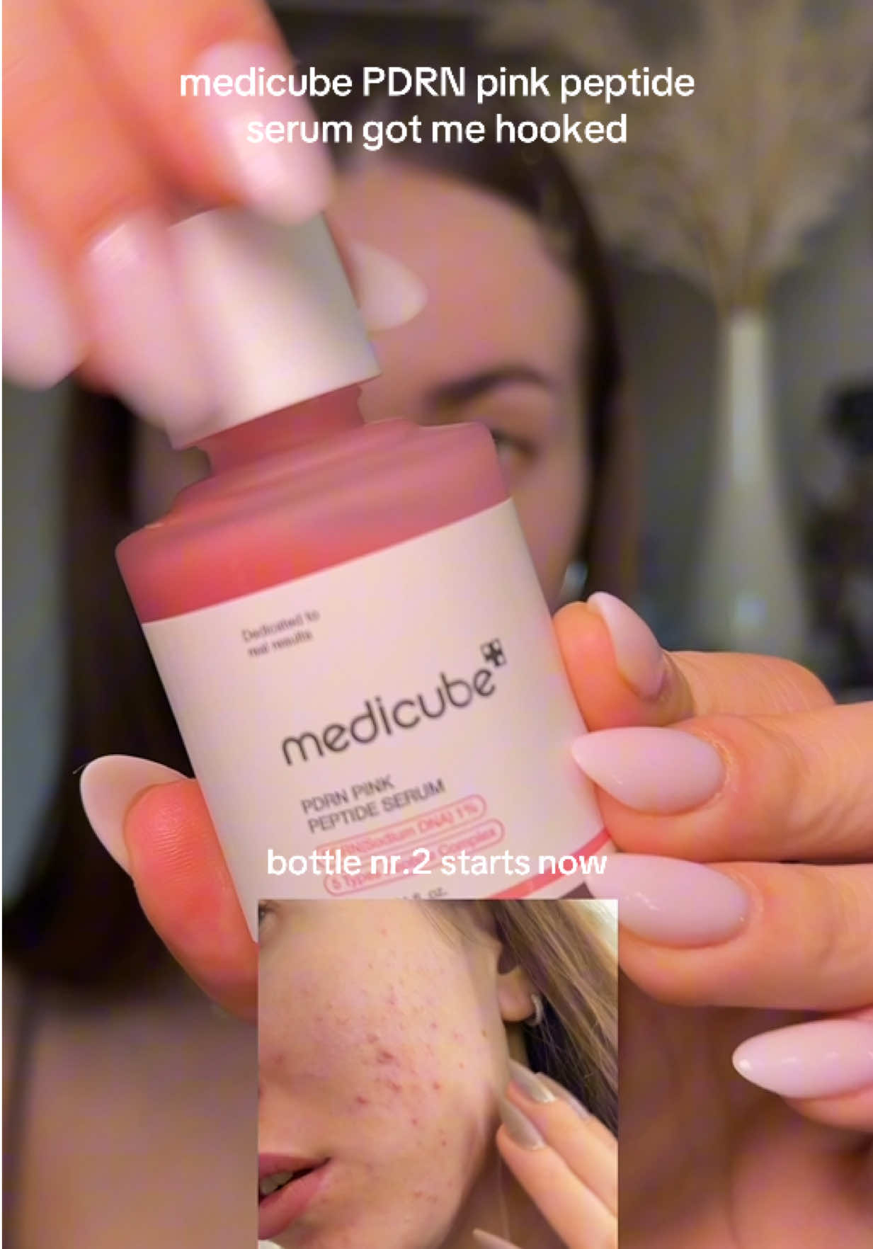 I swear I finished the first bottle in a breath hold, that’s how obsessed I am. Starting my second one now and my skin has never looked this clear. My acne marks are fading, texture is smoother… this Medicube PDRN Pink Peptide Serum is actually changing my life. 🥹💗 #pdrnsalmon #pdrntreatment #pdrnserum #medicube #medicubeserum #medicubepdrn @medicube global 