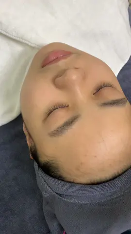 Da giờ đã đẹp #peelda #peel #làmđẹp #mun #thammun 
