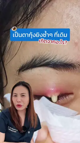 👀ตากุ้งยิงเป็นซ้ำๆ เพราะคุณอาจรักษาไม่ถูกจุด #หมอสกาย #จักษุแพทย์ #skyclinic #ตากุ้งยิง 