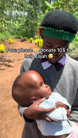 Even 10$ can help Elijah get surgery. Link in the bio to donate 😭🙏 #homelesskids #headsurgery ##headboy #surgery #surgeryrecovery #disability #disabledkid #disabledkids  