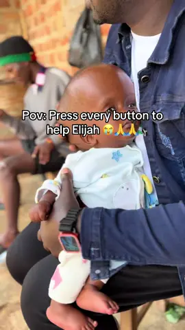 Let’s help get the water out of his head 😭🙏 #homelesskids #headsurgery #surgery #disability #linkinthebio #disabledkid #orphan #headboy 