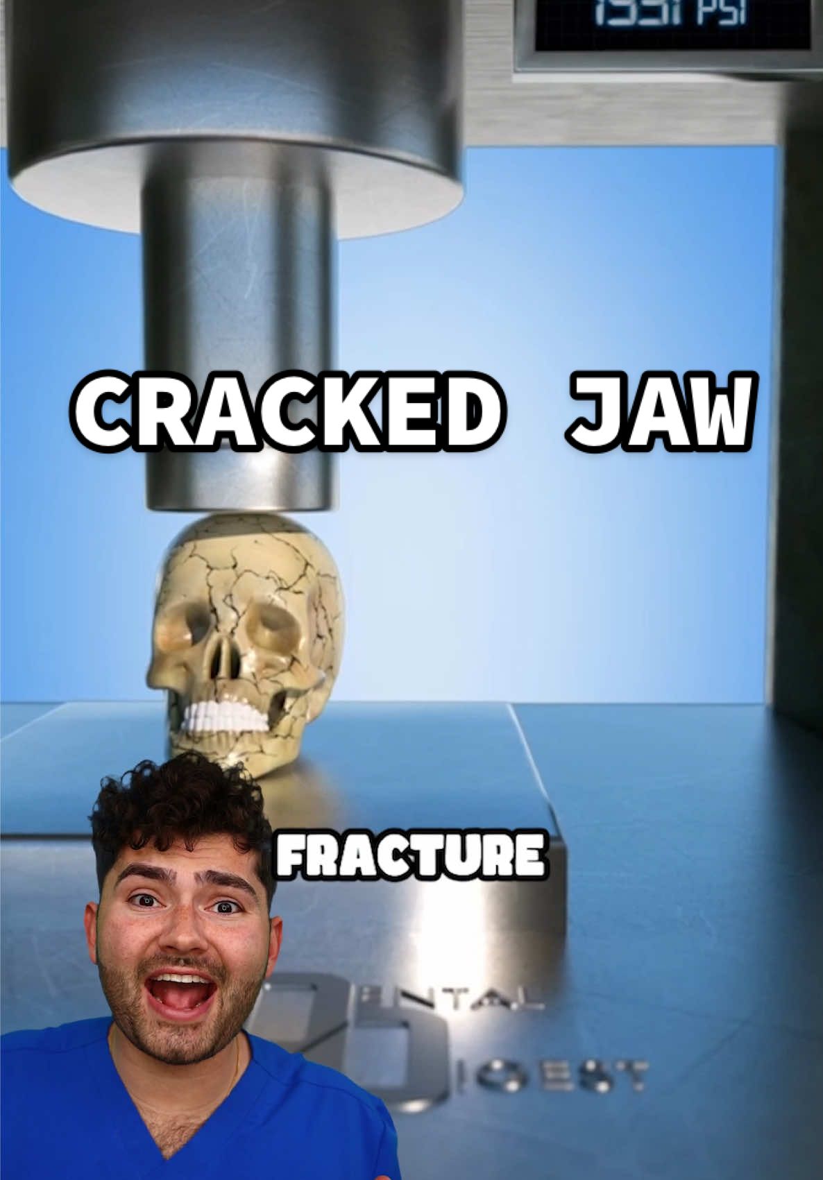 Dentist Explains What Happens When You Crack Your Jaw! 🤯#dentist #surgery #animation #procedure #sports 