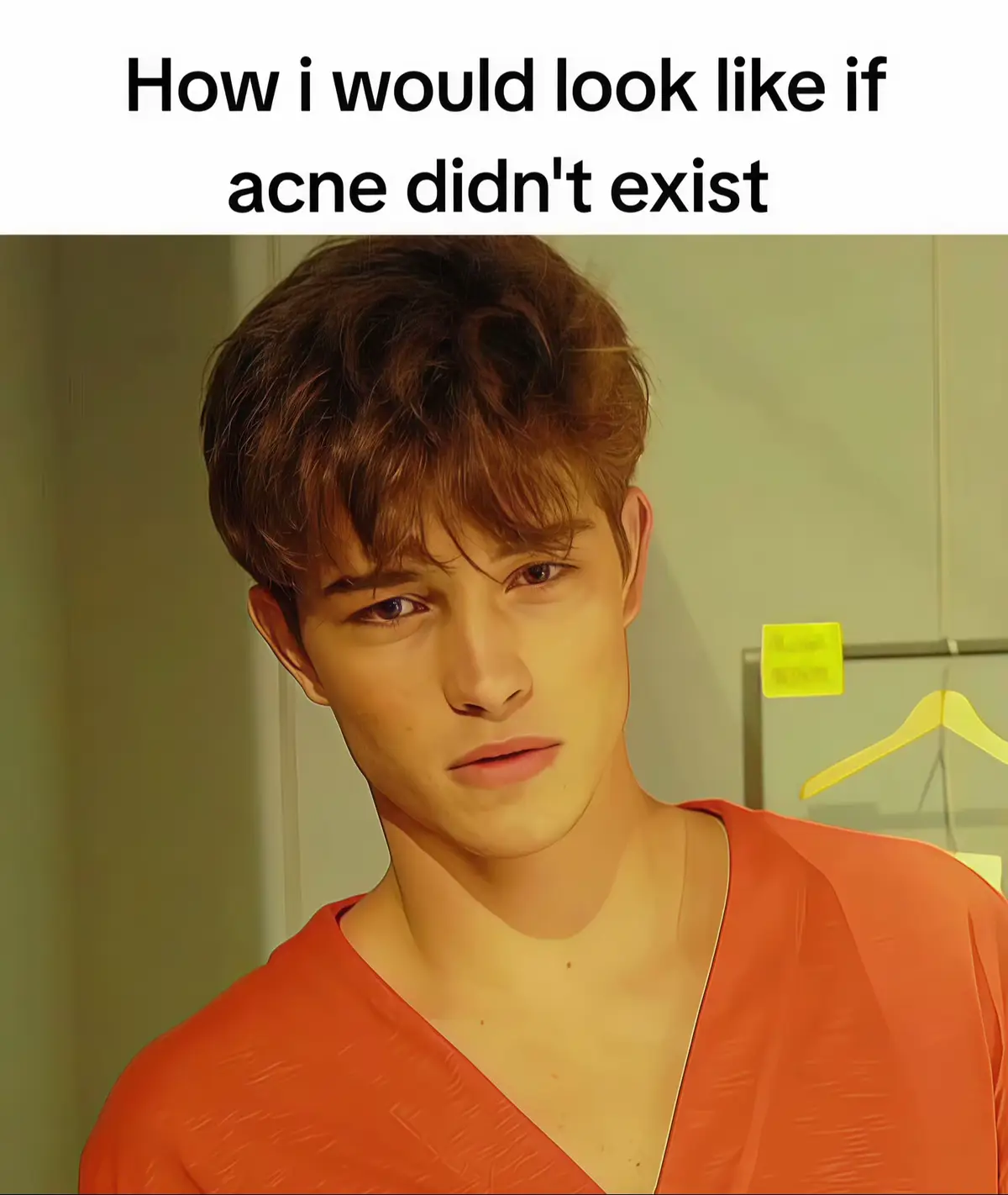 Real (i hate my acne)#chicolachowski #relatable #fyp 