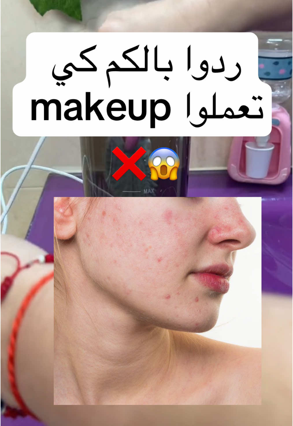أهم حاجة هي النظافة 😍❤️ @Charka.tn  @Charka.tn  @Charka.tn  This electric makeup brush cleaner has undergone a new upgrade. It now utilizes USB charging for a more environmentally friendly power source, replacing the previous battery option. The cleaner can accommodate 3-4 makeup brushes simultaneously, allowing for faster and more efficient cleaning. Additionally, we provide a super soft silicone makeup brush cleaner mat, perfect for cleaning oversized and irregularly shaped brushes either with the machine or manually. [Easy to Use] Add water and make up brush cleaner in a 1:1 ratio, ensuring that the water level doesn't exceed the maximum limit. Once place 3-4 brushes, after the initial cleaning, rinse the brushes with water to remove residue brushes cleaner. For heavily soiled brushes, a second cleaning may be necessary, or use the silicone pad for manual cleaning. Once deep cleaned, flip the silicone cover to allow brushes to air dry. Once dry, store the brushes inside to keep them protected from dust. [Quality Design] Crafted from high-quality materials, our make up cleaner machine features an all-copper motor for durability and safety. Charging via USB adds to the simplicity of operation. With its one-touch switch, turning the machine on or off is effortless, making it convenient for daily use and travel. [Perfect Gift Choice] The make up brush cleaner cleanser machine makes a perfect gift for any beauty enthusiast. Whether it's for Valentine's Day, Christmas, an anniversary, or a birthday, it's sure to delight. Treat yourself or a loved one to the gift of hassle-free makeup brush cleaning. #skincareroutine  #skincare #brushcleaning #pimplesolution #acneskin #skincaretips #makeuphacks 