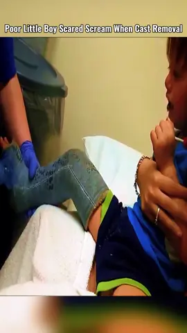 Poor Little Boy Scared Scream When Cast Removal Broken Leg In Front Mother 😳 #castremoval #removal #cutting #castoff #brokenleg #fyp #emotional #poorchild #hospital #doctorstrange 