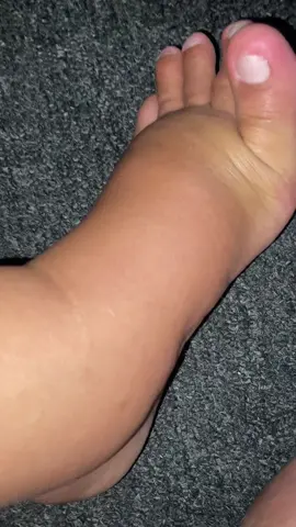 #kakibengkakibuhamil 😭😭