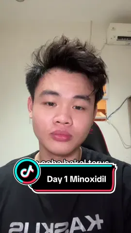 Kalo kalian ada yang pake minoxidil juga tapi takut kelupaan atau ga konsisten? Follow gw ya, biar jadiin gw sebagai pengingat lu dan penyemangat biar kita bisa sama” dapetin mahkota kita balik 👊🏻🔥#minoxidil #hairline #hairlinerestoration #hairloss #penumbuhrambut #haircare #balding 