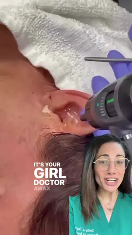 Cockroach in the ear?!!?! I AM NOT WELL!! Did you react the same way?! #earcleaning #bug #cockroach #blindreaction #audiology #audiologist #drearwax 