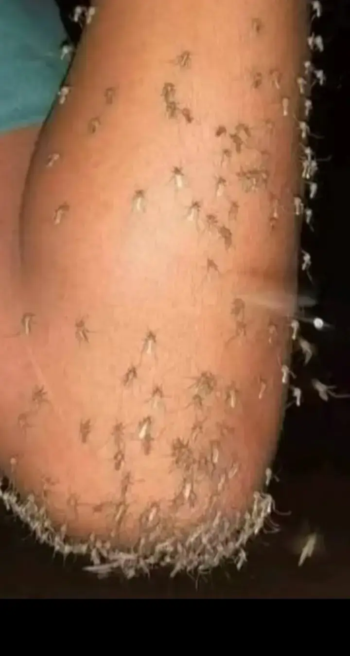 মশা কামড় মারার ভাগনা মশায় কামড় মারে 
