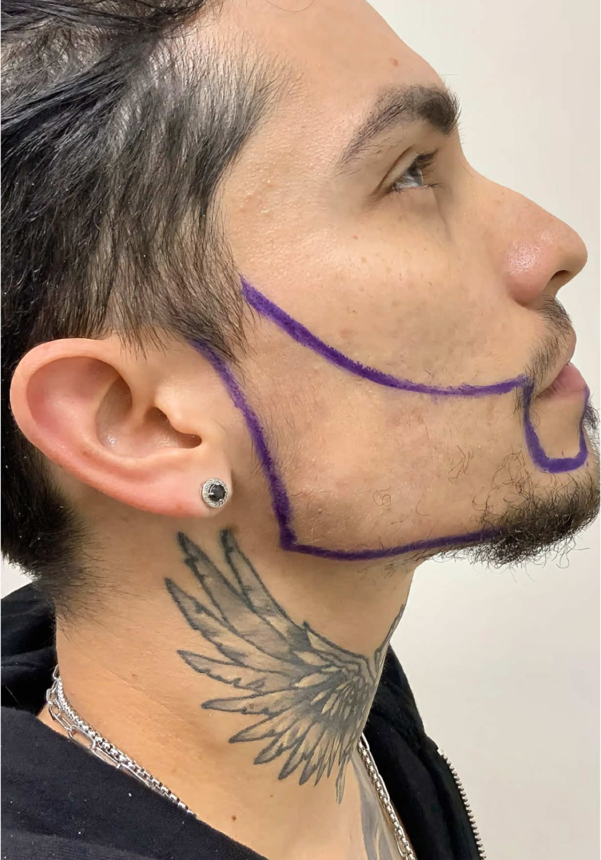 ¿NO TE CRECE LA BARBA? Podemos ayudarte. Hazte un trasplante de barba y consigue ese look que siempre quisiste 🧔✨ ¡Resultados reales, sin filtros! #transplantedebarba #TrasplanteCapilar #cambiodeimagen #looknuevo 