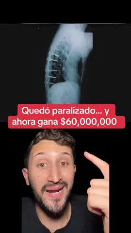 Increíble historia de superación 🤯 #neurogum #sharktank 