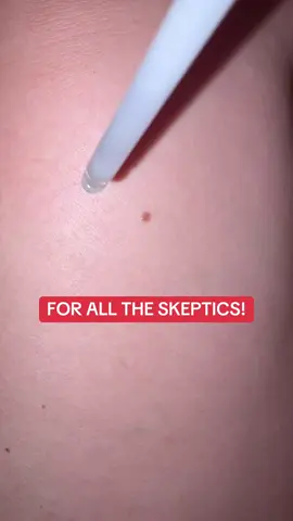 This stuff works!!  Dr. Melaxin you got it right  #peelshot #exfoliate #drmelaxin 